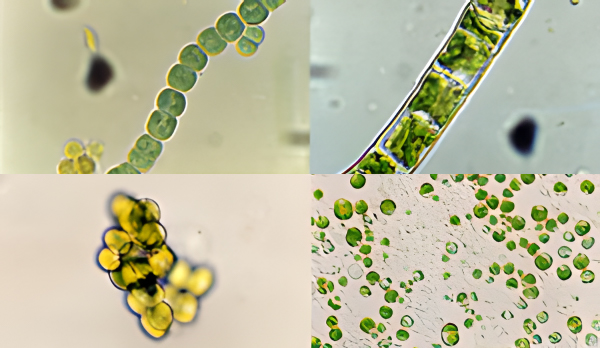 藻顕微鏡写真